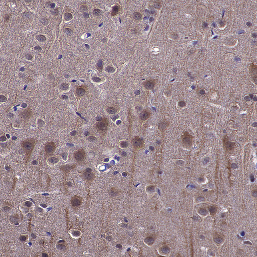 VPS34 Recombinant Rabbit mAb