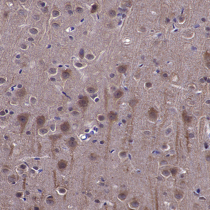 VPS34 Recombinant Rabbit mAb