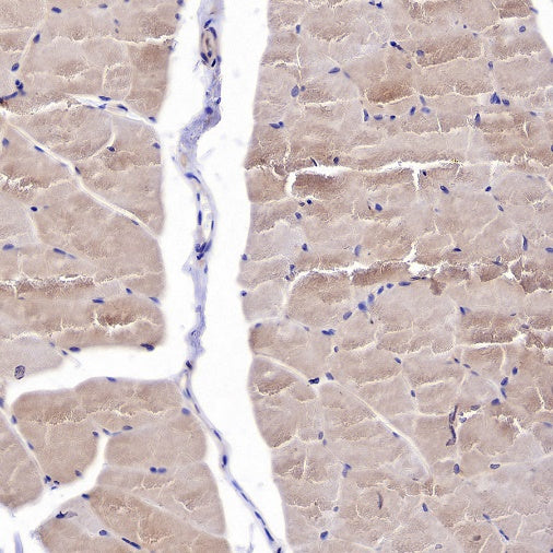 Hamartin/TSC1 Recombinant Rabbit mAb (S-2725-166)