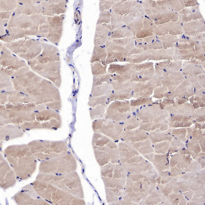 Hamartin/TSC1 Recombinant Rabbit mAb (S-2725-166)