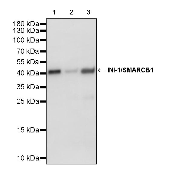 INI-1/SMARCB1 Recombinant Rabbit mAb (S-4068-21)