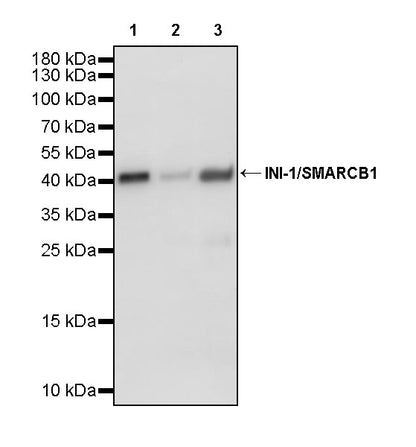 INI-1/SMARCB1 Recombinant Rabbit mAb (S-4068-21)