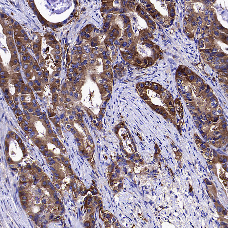 HSP90 alpha/beta Recombinant Mouse mAb (S-5282)