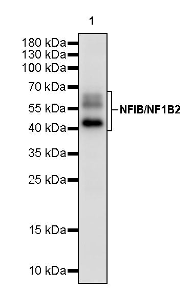 NFIB / NF1B2 Recombinant Rabbit mAb (S-3046-78)