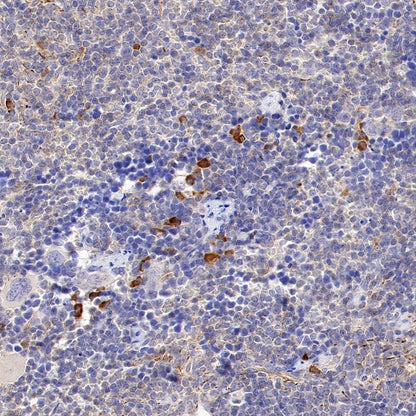 Trim30a Recombinant Rabbit mAb (S-1753-35)