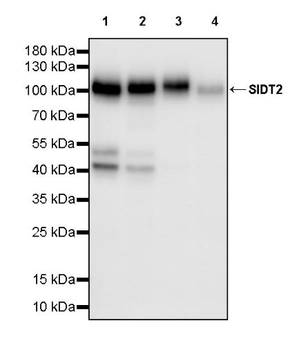 SIDT2 Recombinant Rabbit mAb (S-3763-76)