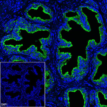 PAP Recombinant Rabbit mAb (SDT-702-140)