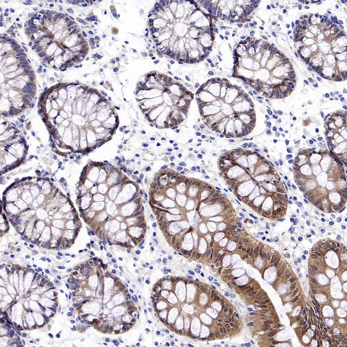 S-RMab® Caspase-7 Recombinant Rabbit mAb (S-1539-42)