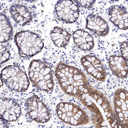 S-RMab® Caspase-7 Recombinant Rabbit mAb (S-1539-42)