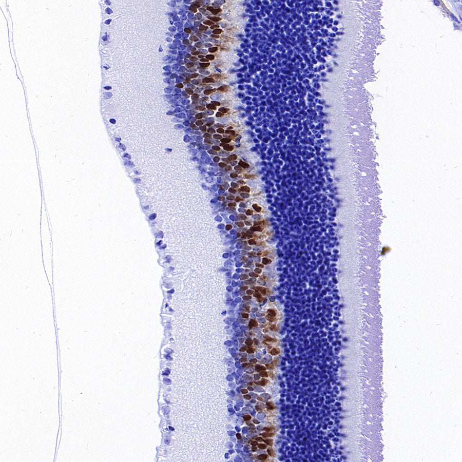 CHX10 Recombinant Rabbit mAb (S-3940-13)