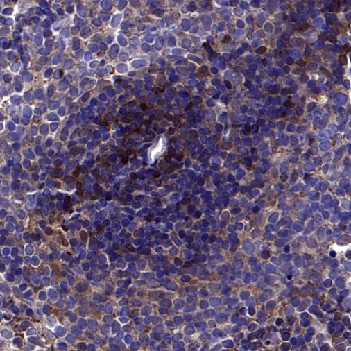 Stat5b Recombinant Rabbit mAb (S-2951-34)