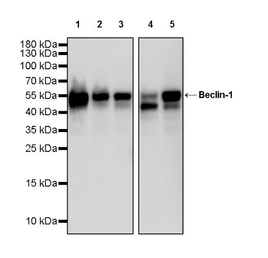 Beclin-1 Recombinant Rabbit mAb (S-761-15)