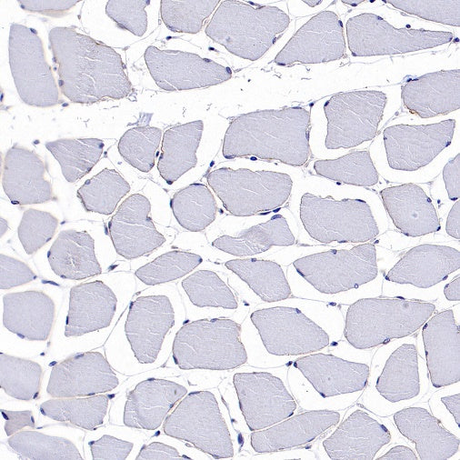 gamma Tubulin Recombinant Rabbit mAb (S-2204-13)