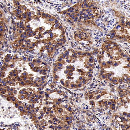 KL Recombinant Rabbit mAb (S-2245-169)
