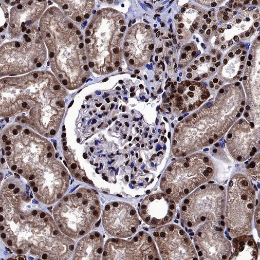 FTO Recombinant Rabbit mAb (S-1663-48)