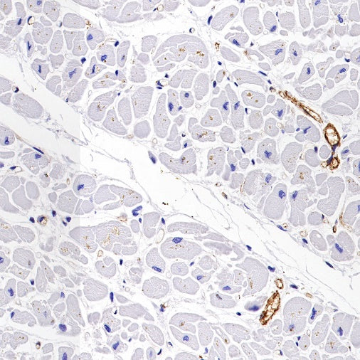 Von Willebrand Factor Recombinant Rabbit mAb (S-663-120)