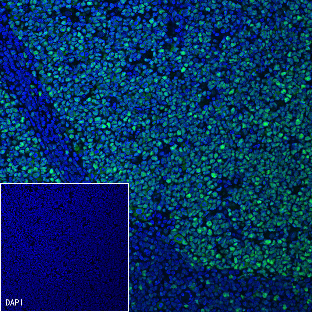 MSH2 Recombinant Rabbit mAb (SDT-037-20)