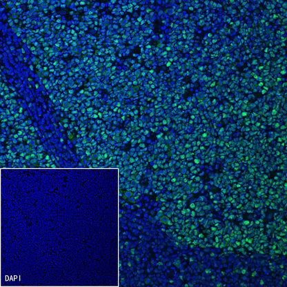 MSH2 Recombinant Rabbit mAb (SDT-037-20)