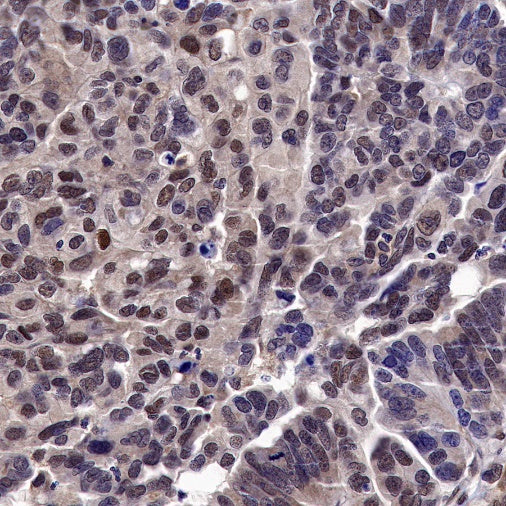 Helios Recombinant Rabbit mAb (S-1299-31)
