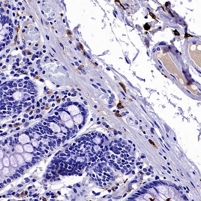 VSIG4 Recombinant Rabbit mAb (SDT-2737-61)