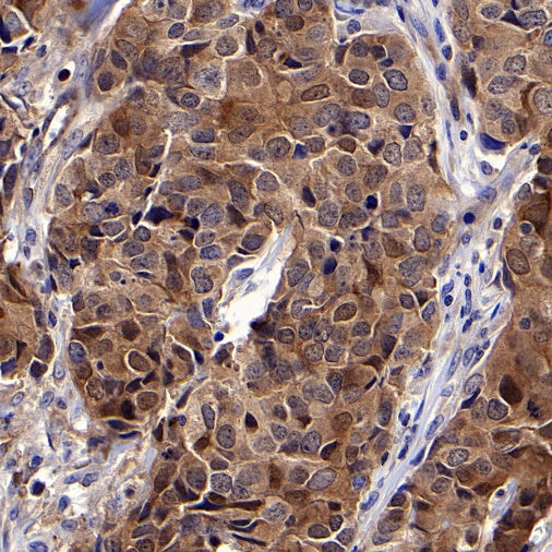 PDCD6 Recombinant Rabbit mAb (S-578-98)