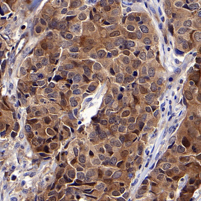 PDCD6 Recombinant Rabbit mAb (S-578-98)
