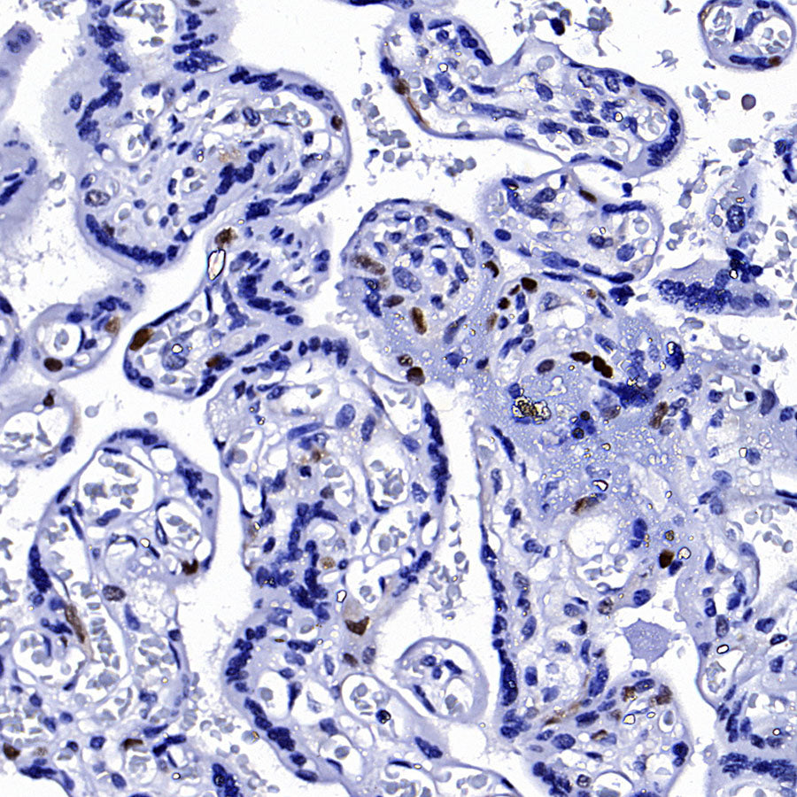 Cyclin E1 Recombinant Rabbit mAb (SDT-4375-44)