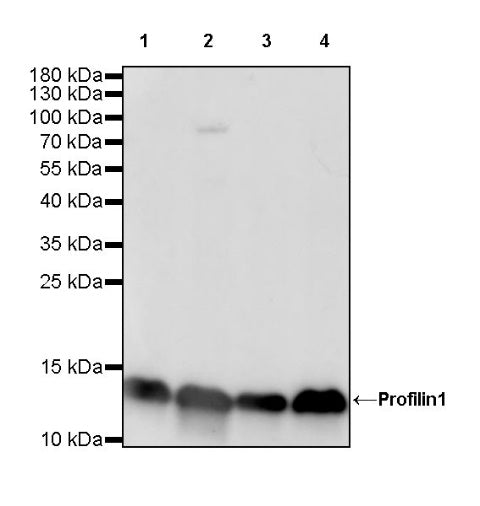 Profilin1 Recombinant Rabbit mAb (S-869-13)