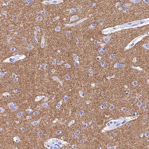 CD56 Recombinant Rabbit mAb (SDT-2427-1)