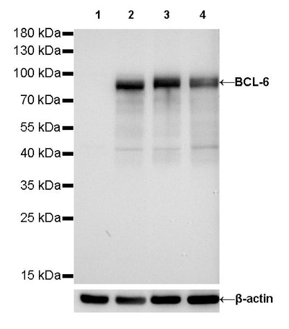 S-RMab® BCL-6 Recombinant Rabbit mAb,PBS Only (SDT-103-21)
