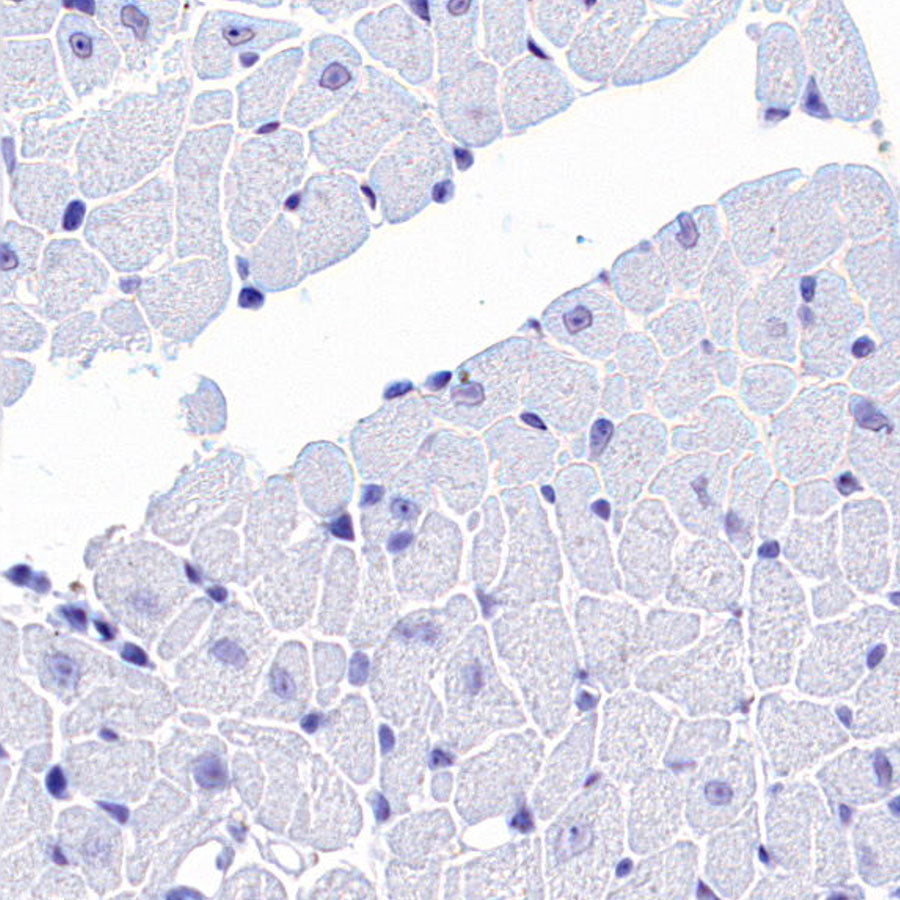 SV2A Recombinant Rabbit mAb (S-3732-3)