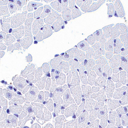 SV2A Recombinant Rabbit mAb (S-3732-3)