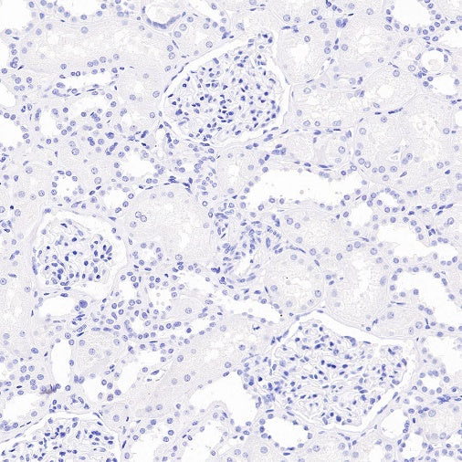 Somatostatin Recombinant Rabbit mAb (S-1103-79)