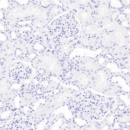 Somatostatin Recombinant Rabbit mAb (S-1103-79)