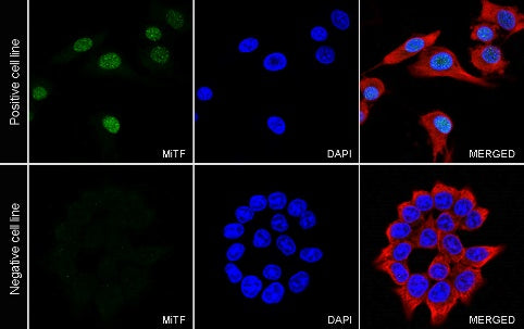 MiTF Recombinant Rabbit mAb (S-1047-50)