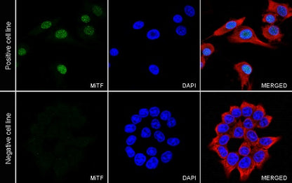 MiTF Recombinant Rabbit mAb (S-1047-50)