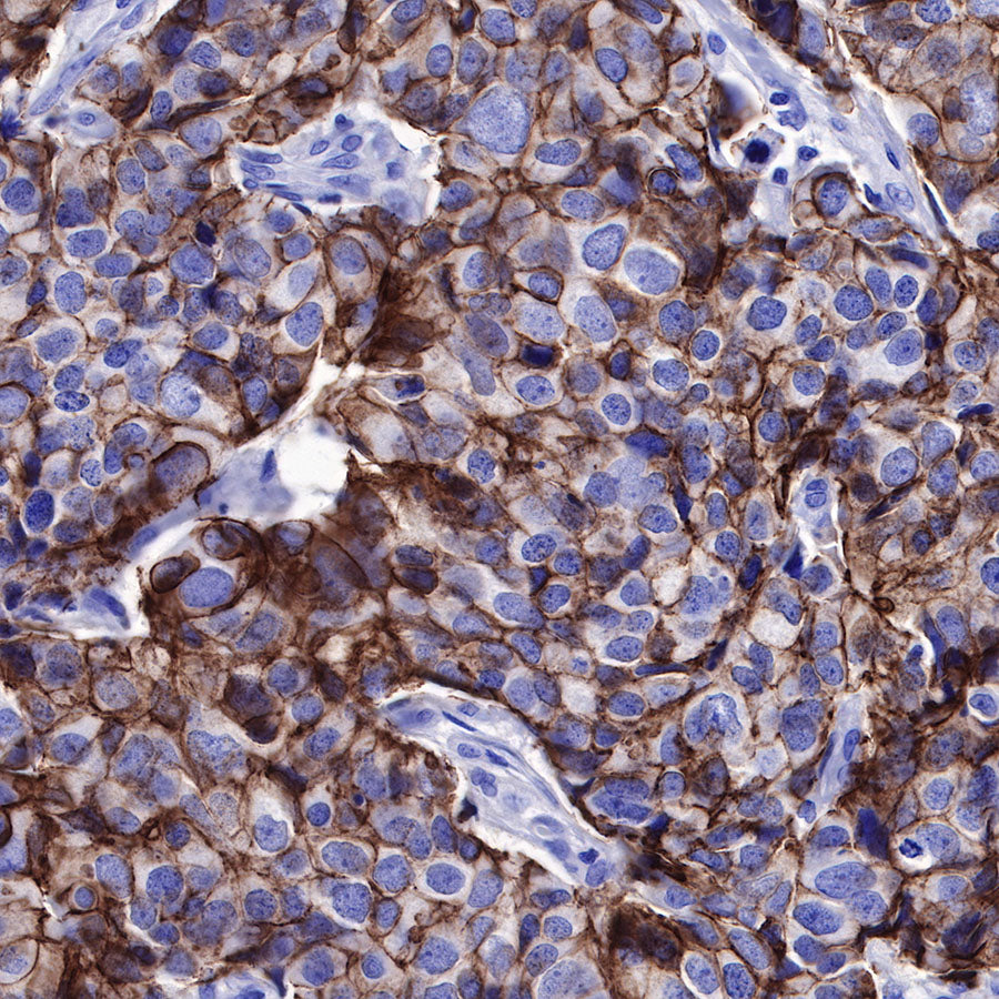 Nectin-4 Recombinant Rabbit mAb (SDT-277-229)