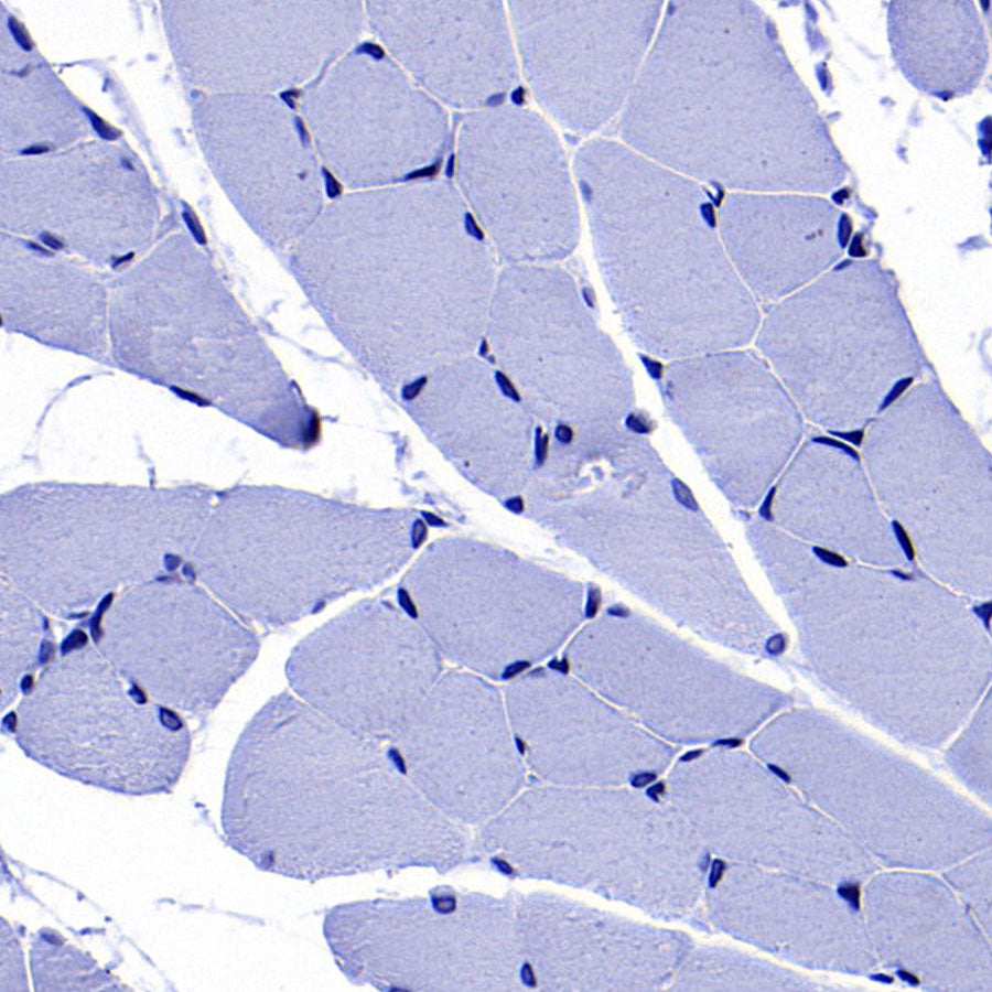 GLUT3 + GLUT14 Recombinant Rabbit mAb (S-5945)