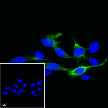 Vimentin Recombinant Rabbit mAb,PBS Only (SDT-029-20)