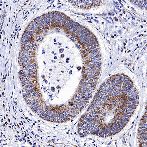 NDUFS8 Recombinant Rabbit mAb (S-1273-10)
