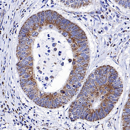 NDUFS8 Recombinant Rabbit mAb (S-1273-10)
