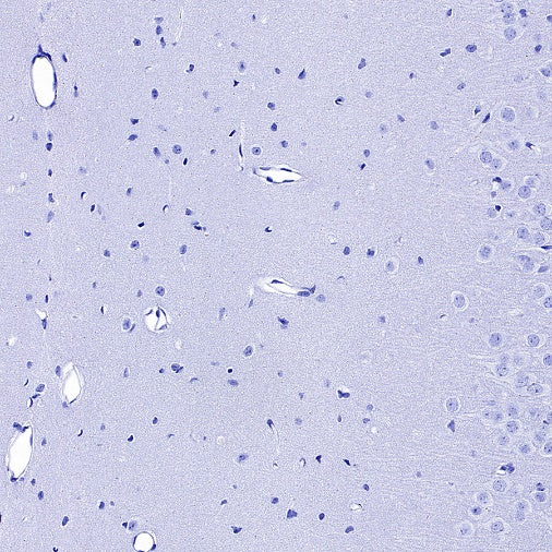 PAD4 Recombinant Rabbit mAb (SDT-2416-3)