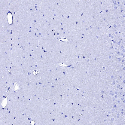 PAD4 Recombinant Rabbit mAb (SDT-2416-3)