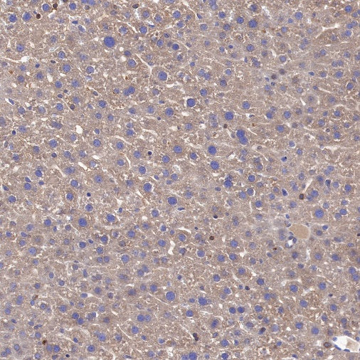 CAD/BM1 Recombinant Rabbit mAb (S-1650-21)