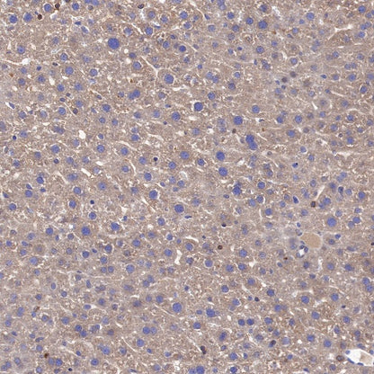 CAD/BM1 Recombinant Rabbit mAb (S-1650-21)