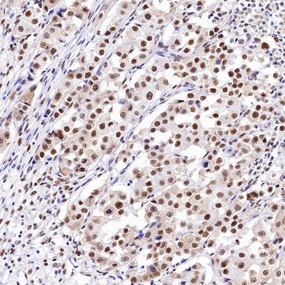 Cyclin K Recombinant Rabbit mAb (S-1586-18)