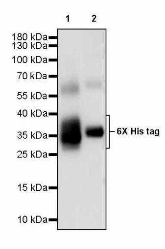6x His tag (C-terminal) Recombinant Rabbit mAb (S-3882)