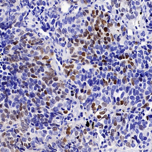 OTP Recombinant Rabbit mAb (SDT-2002-175)