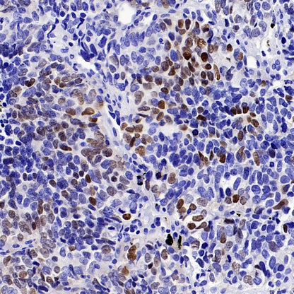 OTP Recombinant Rabbit mAb (SDT-2002-175)