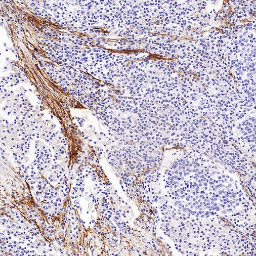 LRRC15 Recombinant Rabbit mAb (S-2473-43)